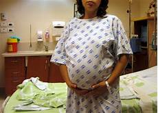 Contractions