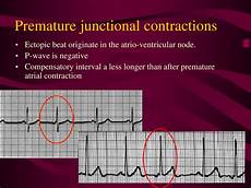 Contractions